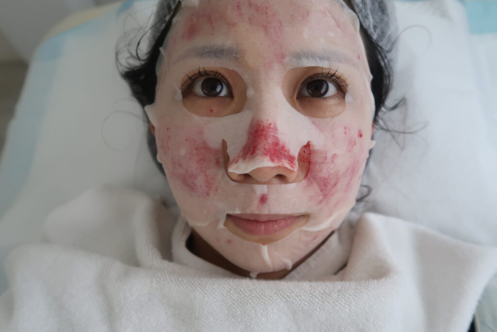 マレーシアでシミ取りレーザー治療 The Lush Clinic 料金 施術の流れ 経過 クリニック比較など一挙大公開 歩くマレーシア情報網